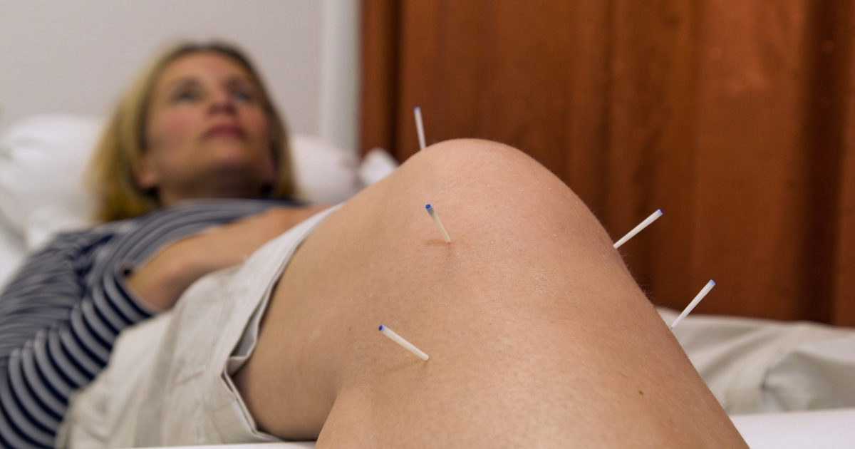 Cara Mengobati Nyeri Lutut dengan Terapi Akupunktur